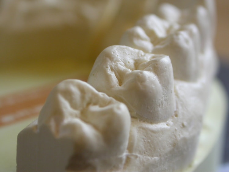 06_dental_moulds_dsc_sJpkp 06_dental_moulds_dsc_sJpkp